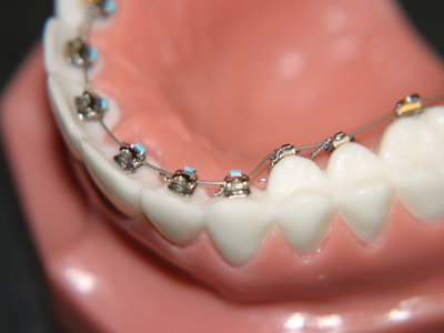 ортодонтическая стоматология